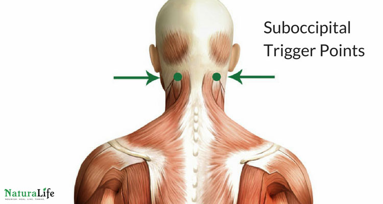 Melt Away Headaches With Trigger Point Therapy
