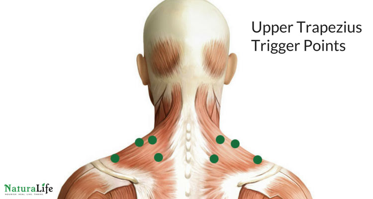 Melt Away Headaches With Trigger Point Therapy - Naturalife