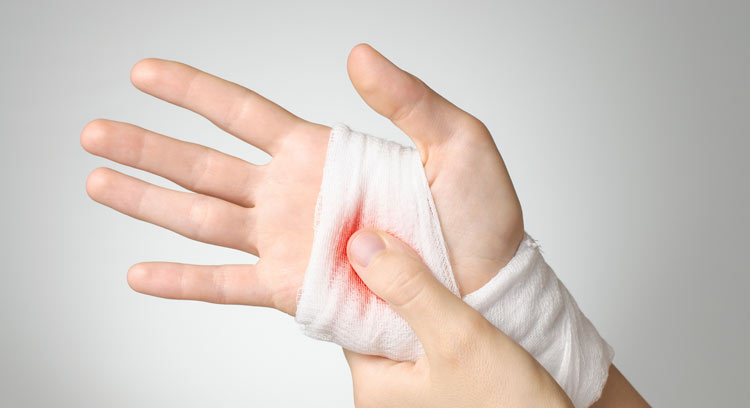 guide to inflammation with wounded hand